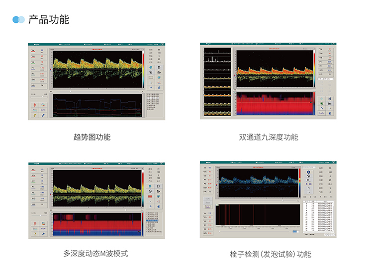 便攜式超聲經(jīng)顱多普勒血流分析儀